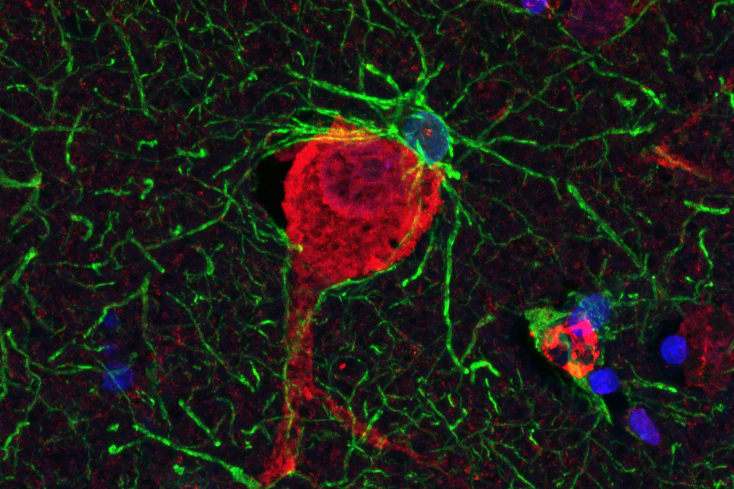 Brain cells